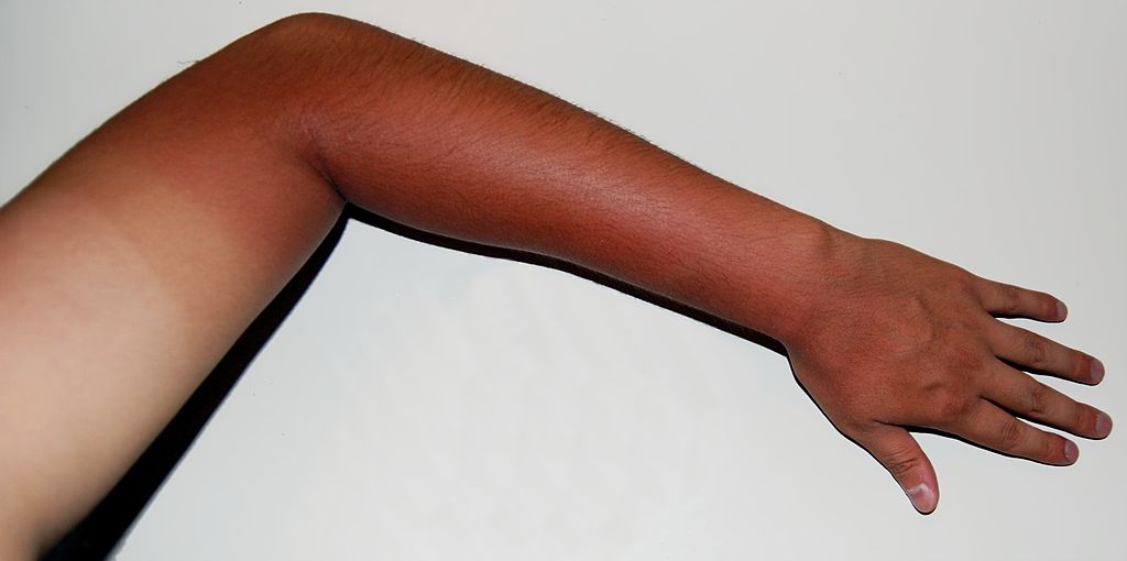 Tans jump on the Organic bandwagon ... good news for the environment? Tans jump on the Organic bandwagon ... good news for the environment?